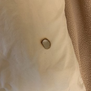 Pilgrim Motel - cigarette burn in pillowcase - Hotels Near Me - Lee, Massachusetts