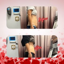Slim Reveal Body Sculpting - Cavitation for fat loss & Radio Frequency (RF) for skin tightening
