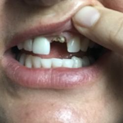 Lake Family Dental