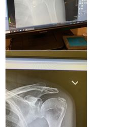 Rad Expert MD - Before Dr. Reza Dehdari, and after seeing the Dr. Thank you so much for your help.
