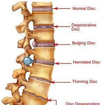 Denton Chiropractic Center - untitled - Chiropractors Near Me - Denton, Texas
