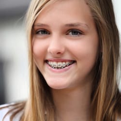 Joseph M. Haack DDS - Family Dentistry and Orthodontics - Alexandria dental patient with braces by Dr Joseph M Haack, DDS