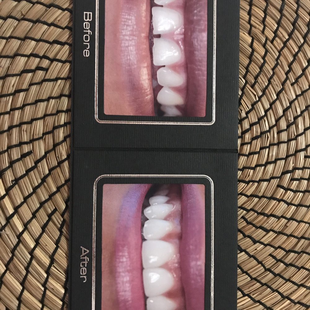 Gregory Le, DMD - Cosmetic Dentists Near Me - Fountain Valley, California Gregory Le, DMD - Cosmetic Dentists Near Me - Fountain Valley, California