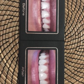 Gregory Le, DMD - Cosmetic Dentists Near Me - Fountain Valley, California Gregory Le, DMD - Cosmetic Dentists Near Me - Fountain Valley, California