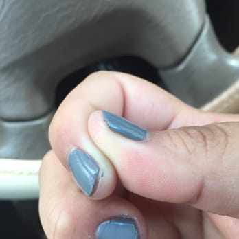 Ace Nail Spa - the young Asian guy does a Crappy job. Don't ever let him do your nails! I promise it's a waste of money! - Hair Removal Near Me - Stamford, Connecticut