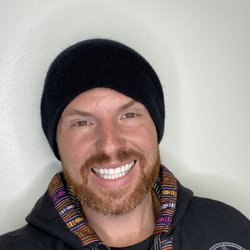 Luma Teeth Whitening - White teeth smile