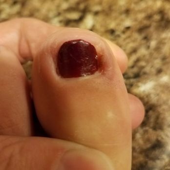 Dream Nails - Disgusting work - Nail Salons Near Me - Kennesaw, Georgia