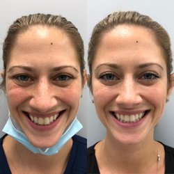 MediGlow