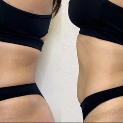 Essential Beauty Aesthetics - 1 hour treatment
