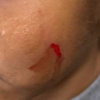 Rancho Cordova KinderCare - The scratcher nobody had any answers about for two days. - Child Care & Day Care Near Me - Rancho Cordova, California Rancho Cordova KinderCare - The scratcher nobody had any answers about for two days. - Child Care & Day Care Near Me - Rancho Cordova, California