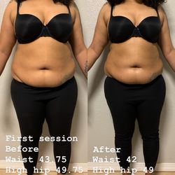 Sweet Jones Beauty - Body Contouring