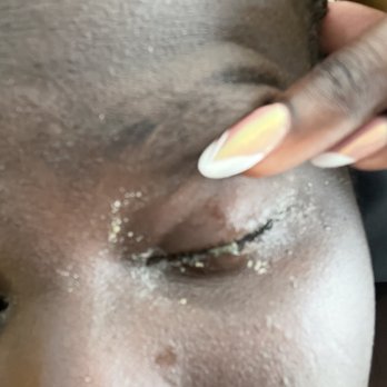 Tammy's Eyebrow Spa - Eyes glued shut the morning after removing the lashes. - Eyelash Service Near Me - New York, New York Tammy's Eyebrow Spa - Eyes glued shut the morning after removing the lashes. - Eyelash Service Near Me - New York, New York