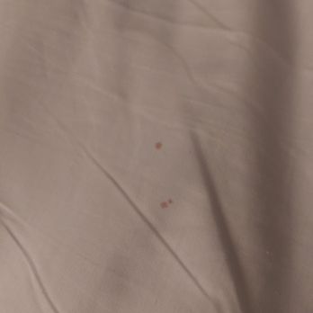ALO Hotel by Ayres - Blood drop stains - Hotels Near Me - Orange, California