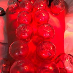 Xiuling Ma, PhD OMD - Cupping