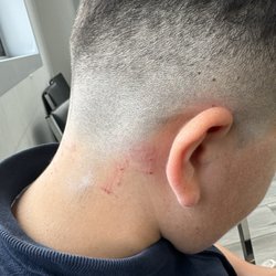 Alex Barber Shop - Neck and both ears full of cuts