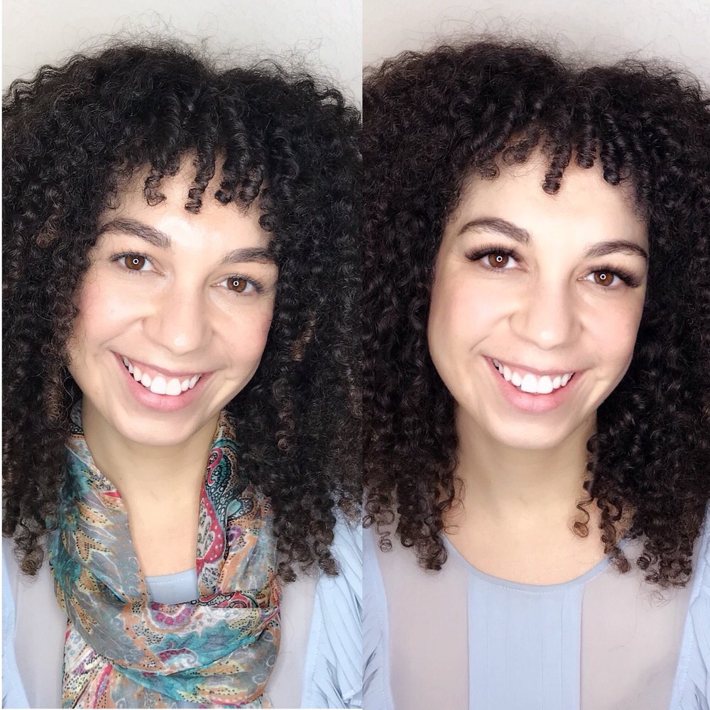 Mallory Gargan - Before and after - Massage Therapy Near Me - Rohnert Park, California Mallory Gargan - Before and after - Massage Therapy Near Me - Rohnert Park, California
