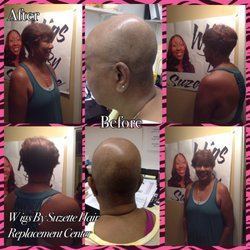 Wigs By Suzette Hair Replacement Center - Before Cranial Prosthetic and after installation