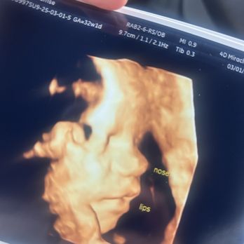 4D Miracles - Ultrasound Imaging Centers Near Me - Fremont, California 4D Miracles - Ultrasound Imaging Centers Near Me - Fremont, California