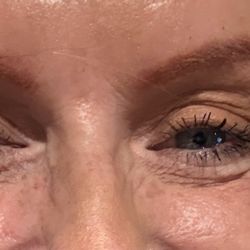 UPKEEP - Day of injections