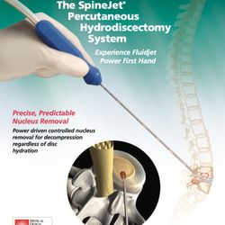 Vanguard Interventional Pain Specialists - SpineJet uses a high-speed water stream to remove herniated disc tissue, thereby relieving the nerve pressure that causes back and leg pain.