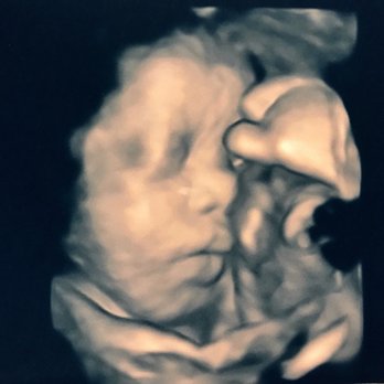 The Baby Connection - i like the image and color of this one. - Diagnostic Imaging Near Me - Sacramento, California The Baby Connection - i like the image and color of this one. - Diagnostic Imaging Near Me - Sacramento, California