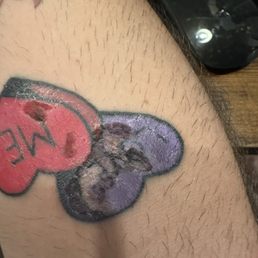 This was the healing process so he said after the artist went to deep not only did it leave a scar on my arm it also lost color! This was the healing process so he said after the artist went to deep not only did it leave a scar on my arm it also lost color!