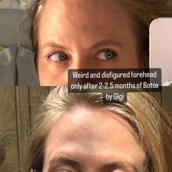 Genevieve Vielbig NP-BC - Bad Botox