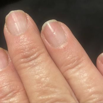 Polished Nail Lounge - Nails on the right hand seemed to have been sanded thinner. These are breaking daily. Ring finger has particularly bad groove. - Nail Salons Near Me - Houston, Texas Polished Nail Lounge - Nails on the right hand seemed to have been sanded thinner. These are breaking daily. Ring finger has particularly bad groove. - Nail Salons Near Me - Houston, Texas