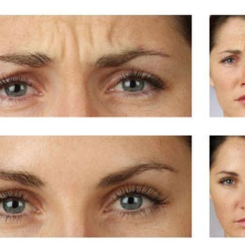 Spa Three Ten - We offer Botox services at Spa310 - Hair Salons Near Me - Richmond, Virginia Spa Three Ten - We offer Botox services at Spa310 - Hair Salons Near Me - Richmond, Virginia