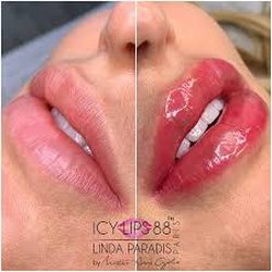 Haven Body Art - Icy lips, non-invasive, painless, safe semi-permanent lip pigment.