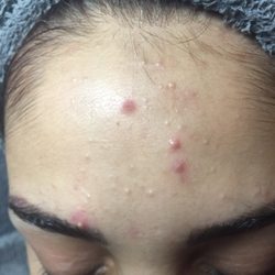 Moonlight Skin Care