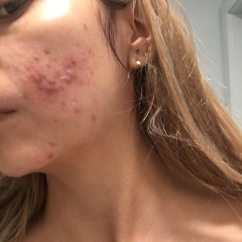 Yuly Gorodisky, DO, FACOS - Cosmetic Surgeons Near Me - Oxnard, California Yuly Gorodisky, DO, FACOS - Cosmetic Surgeons Near Me - Oxnard, California