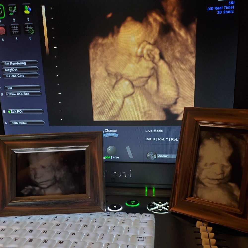 3D4D BABY MOBILE ULTRASOUNDS Updated October 2024 52 Photos & 23