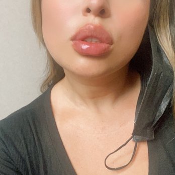 The Image Center - Botox and lip fillers!! - Plastic Surgeons Near Me - Irvine, California The Image Center - Botox and lip fillers!! - Plastic Surgeons Near Me - Irvine, California