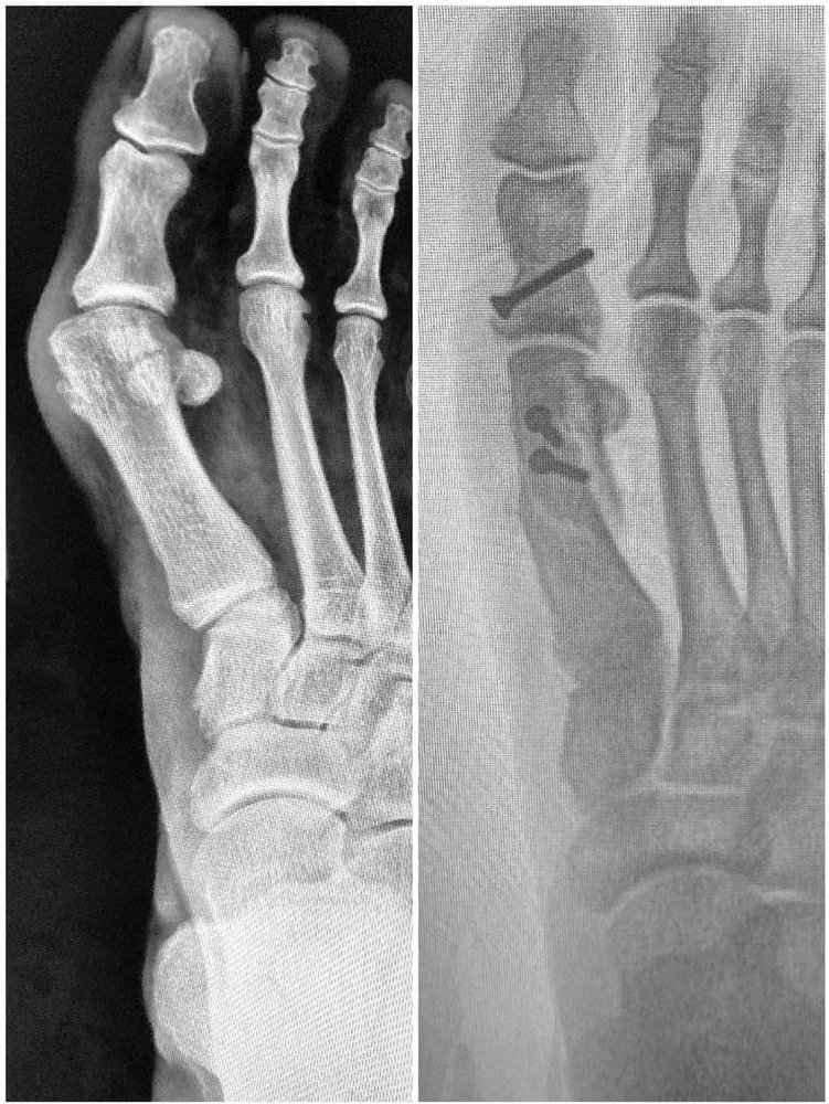 FOOT FIRST PODIATRY CENTER PC Updated August 2024 117 Photos 4350