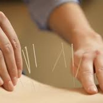 Seattle Fertility Acupuncture - Acupuncture for fertility in Seattle WA - Acupuncture Near Me - Seattle, Washington Seattle Fertility Acupuncture - Acupuncture for fertility in Seattle WA - Acupuncture Near Me - Seattle, Washington