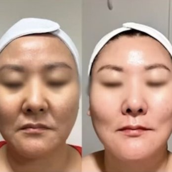Bella Diosa Beauty - Timeless peel instantly brightens and firms skin - Permanent Makeup Near Me - Albuquerque, New Mexico