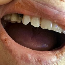 Dental Options