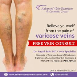 Amjad Safvi, MD - Advanced Vein Treatment and Cosmetic Center - Free Vein Consult by Acclaimed Vein Specialist Dr. Amjad Safvi MD for varicose veins and spider veins treatment.
