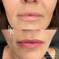 Kissd By Kim - HEALED LIP TATTOO
