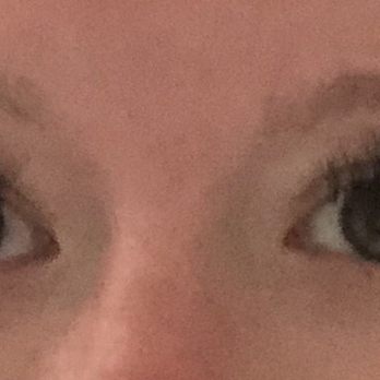 Stellar Aesthetics - This was 3 days after getting the extension - note the awkward bald spot through my right eye. - Eyelash Service Near Me - Scottsdale, Arizona Stellar Aesthetics - This was 3 days after getting the extension - note the awkward bald spot through my right eye. - Eyelash Service Near Me - Scottsdale, Arizona