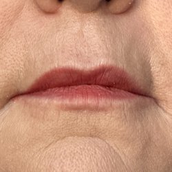 Derma Health Skin & Laser - After. Untouched photos.