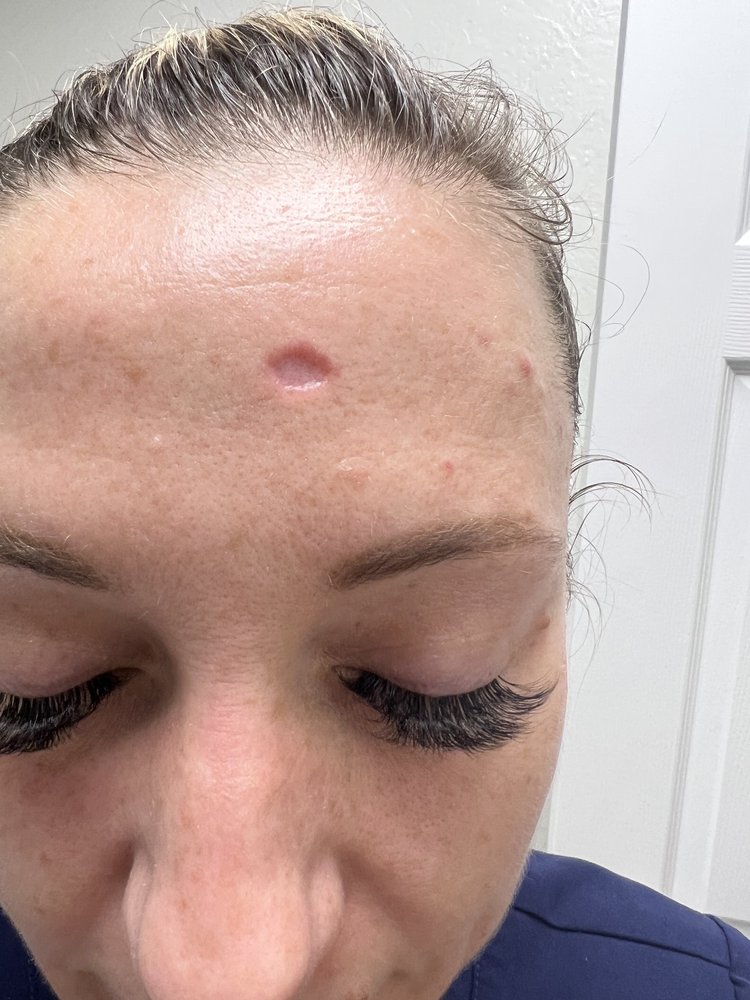 LESLIE STOREY, MD VALLEY SKIN INSTITUTE Updated October 2024 34 Photos & 37 Reviews 7777