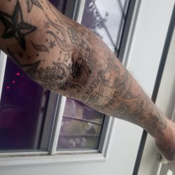 United Medical Imaging Bellflower - CT tech missed my vein and filled my arm with contrast massaged so raw wore a hole in my arm had to miss 3 days of work and went to urgent