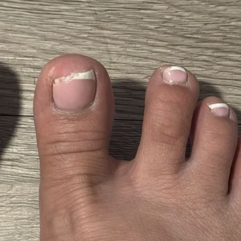 The X Nail - Chipped pedicure - Nail Salons Near Me - Ontario, California The X Nail - Chipped pedicure - Nail Salons Near Me - Ontario, California