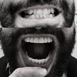 Inglewood Dental & Orthodontics - Before/After