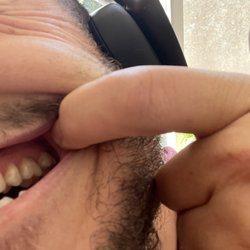 Advantage Dental - Beaverton - Gum tissue recession