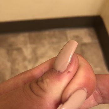 Nail Works - when he filed my nails he really dug into it the cut and again the acrylic and polish is uneven - Nail Salons Near Me - Oxnard, California Nail Works - when he filed my nails he really dug into it the cut and again the acrylic and polish is uneven - Nail Salons Near Me - Oxnard, California