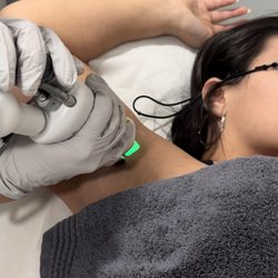 Studio M Aesthetics & Med Spa - Splendor X by Lumenis Laser Hair Removal