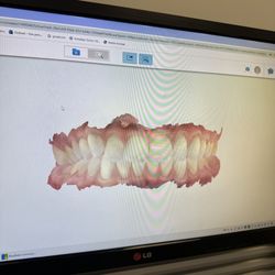 Desert Dentistry - My digital scan
